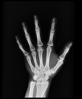 Medical supplies article on hand x-rays